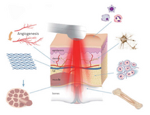 Load image into Gallery viewer, Low Level Laser Handheld Device