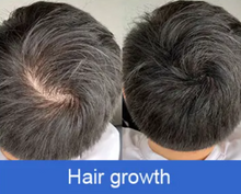 Load image into Gallery viewer, 900 LED Red Light Therapy Cap for hair growth